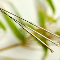 Mærk den tydelige forbedring hos Boel Akupunktur